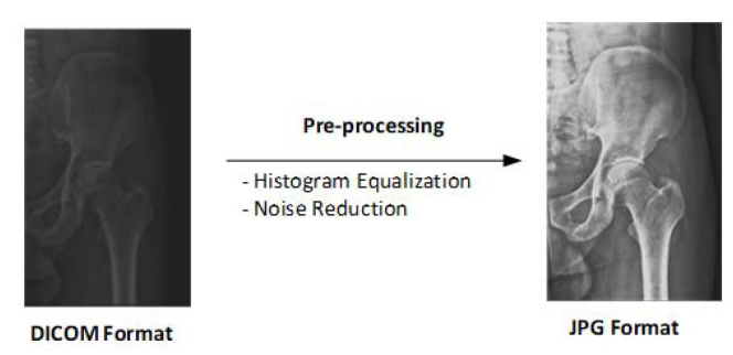 Preprocessing-image